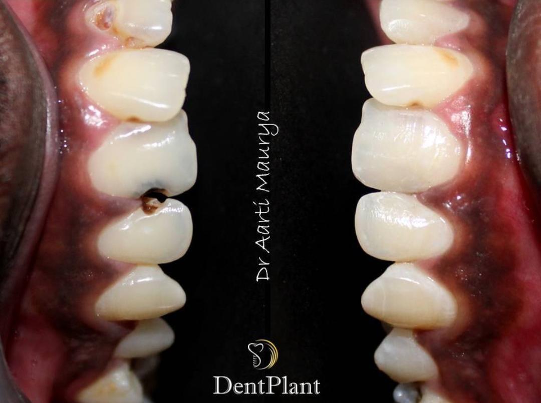 Before After Transformation